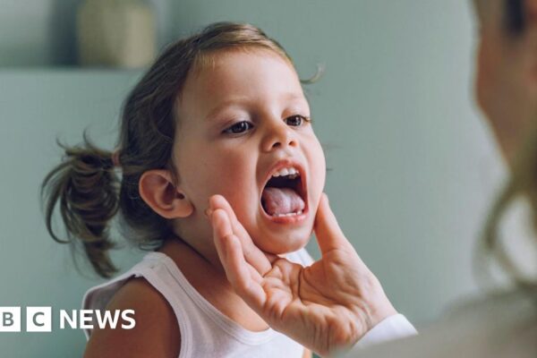Big drop in child surgery for objects swallowed or stuck up nose