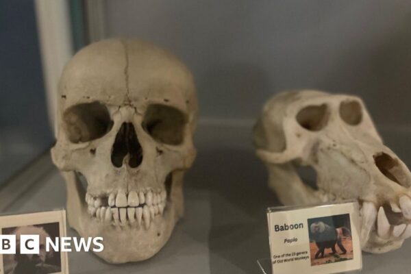 King's College scientists' lab-grown human teeth breakthrough