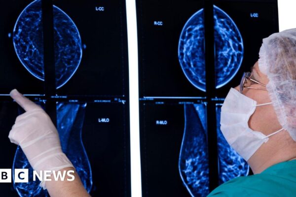 New pill can slow progression of incurable breast cancer