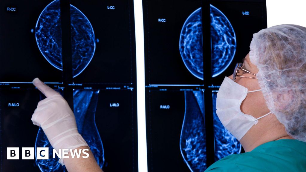 New pill can slow progression of incurable breast cancer