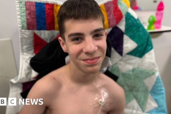 Essex teenager left unable to eat due to rare digestive condition